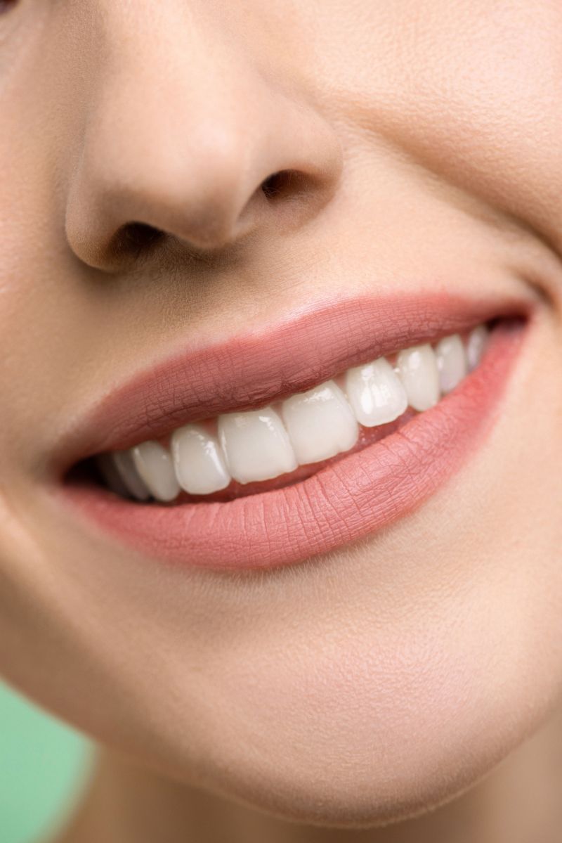 Sonrisa después del tratamiento