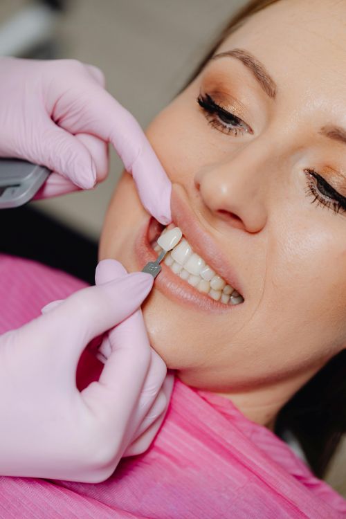 Estética dental
